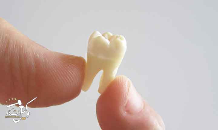 دیه دندان شیری